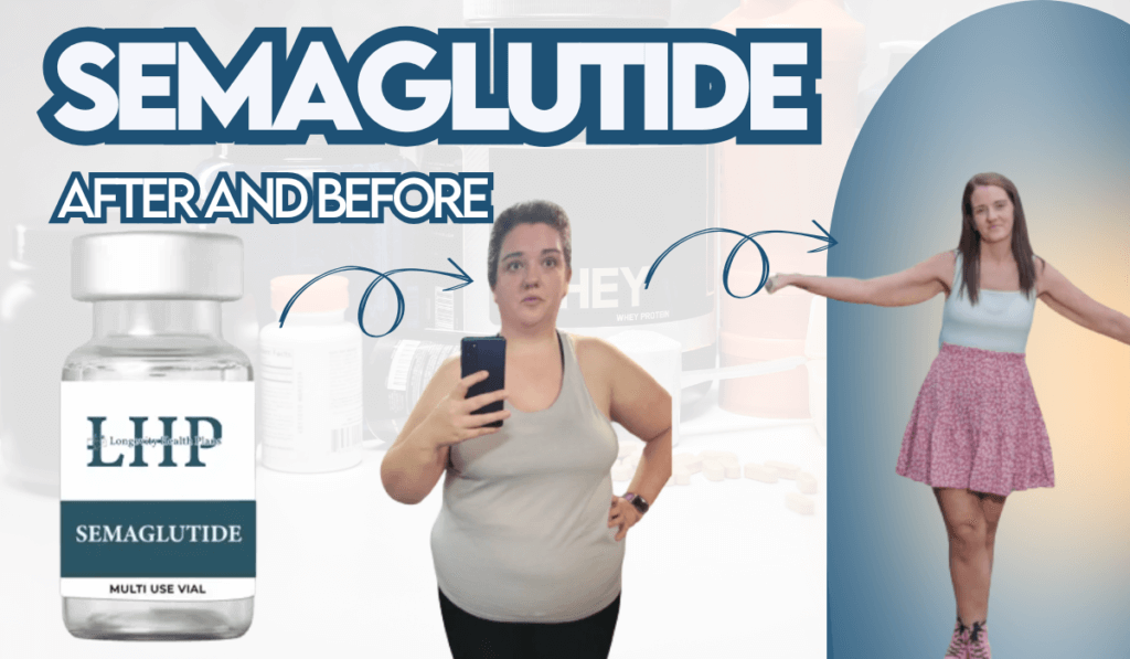 Semaglutide Weight Loss Before and After