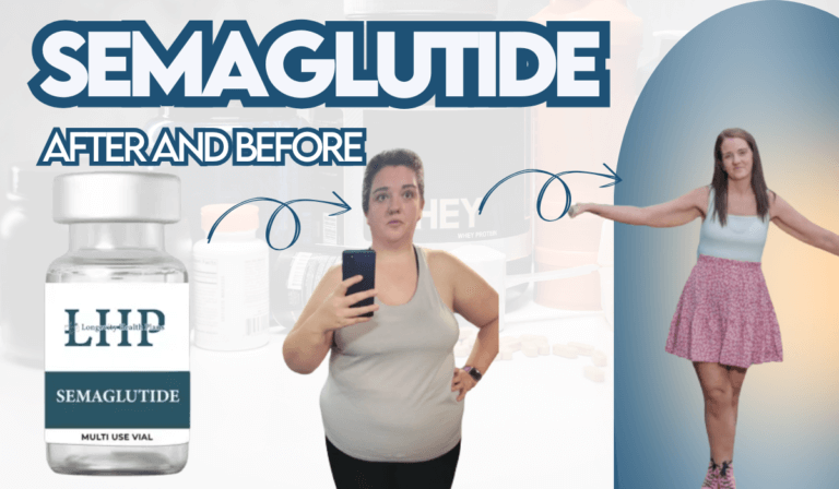 Semaglutide Weight Loss Before and After